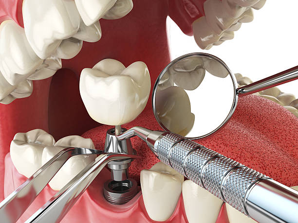 Tooth Infection Emergency Dentist in TN